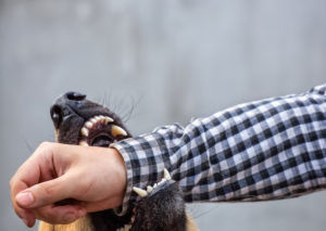 How Baggett Law Can Help After a Dog Bite in Jacksonville