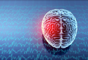 What Are the Signs and Symptoms of Brain Injuries?