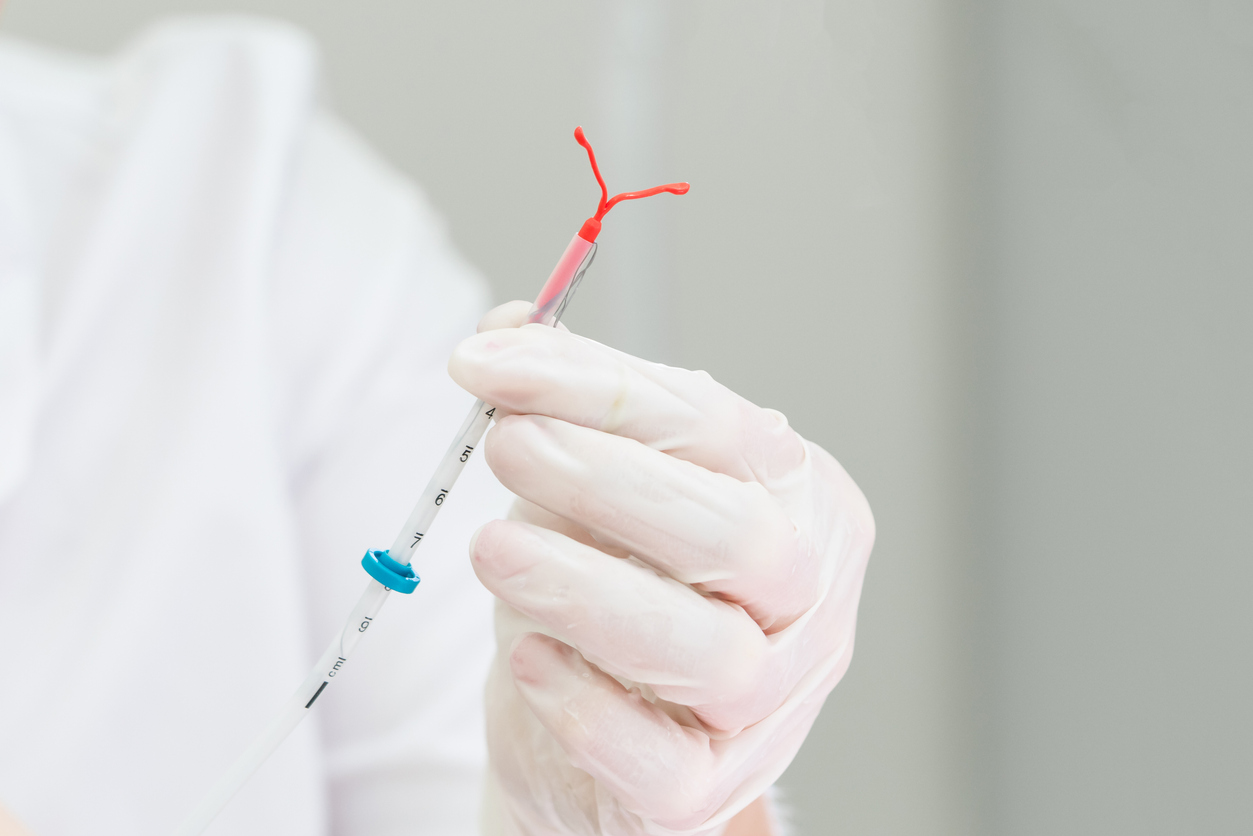 Has Your Mirena IUD Moved